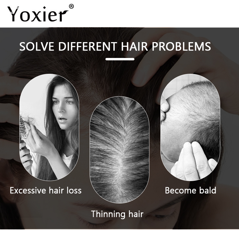 Yoğun büyüme serumu önlemek sa - Hair Care Treatment incelemesi ve fiyatı