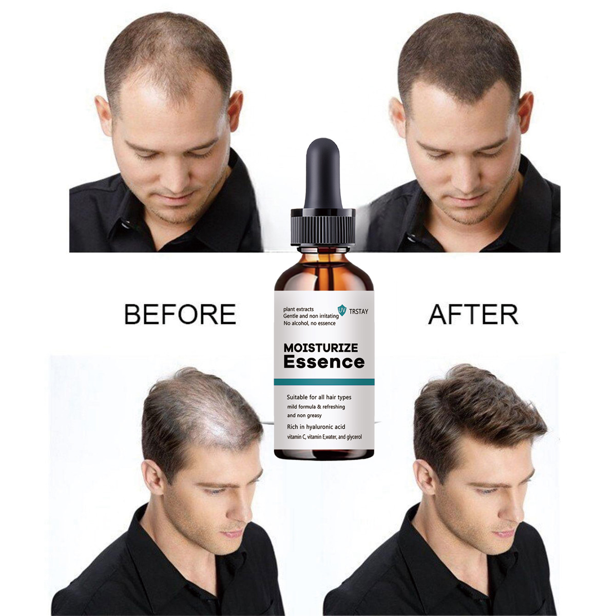 2022 Yeni Saç Büyüme Özü Saç B - Hair Care Ordinary incelemesi ve fiyatı